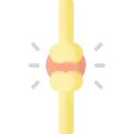 Osteoporosis